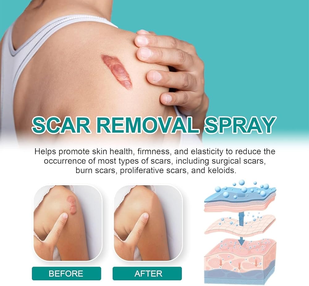 Scar Spray